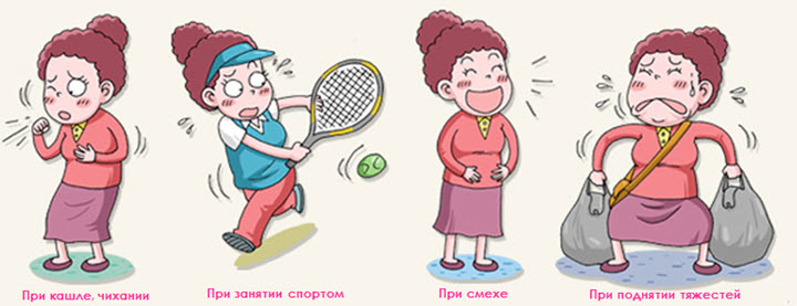 недержание мочи лечение днепр